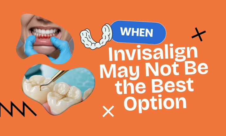 Dental Restorations and Gum Disease