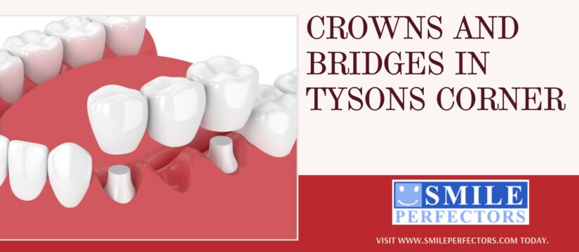 Crowns and Bridges Tysons Corner, Smile Perfectors