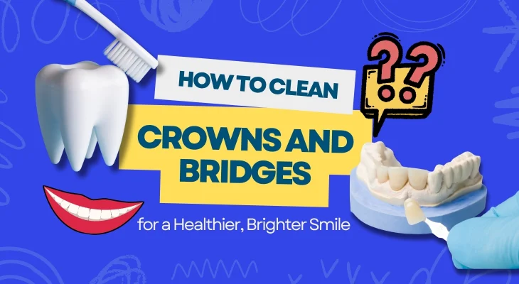 How to Clean Crowns and Bridges