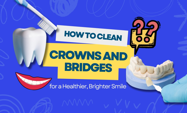 How to Clean Crowns and Bridges