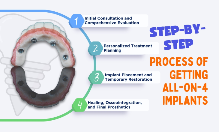 Step-by-Step Process of Getting All-On-4 Implants Infographic
