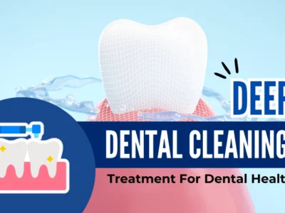 Deep Dental Cleaning – An Effective Treatment For Dental Health