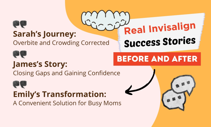 Real Invisalign Before and After Success Stories