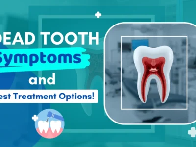 Common Dead Tooth Symptoms and the Best Treatment Options!