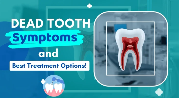 Dead Tooth Symptoms and Treatments