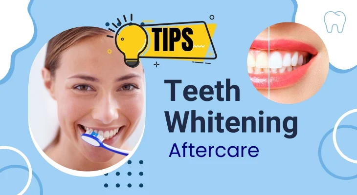Teeth Whitening Aftercare Tips