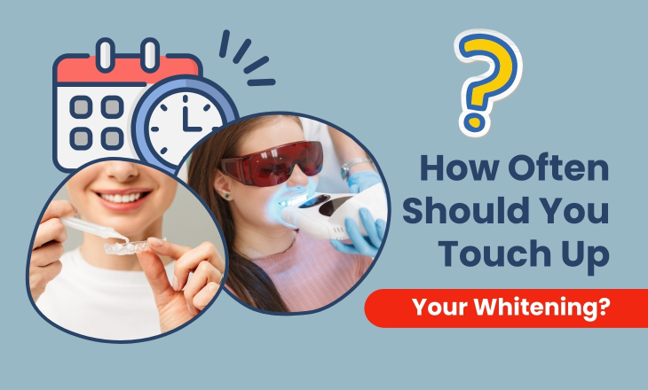 Two Women Whitening Teeth with Laser and Home kit