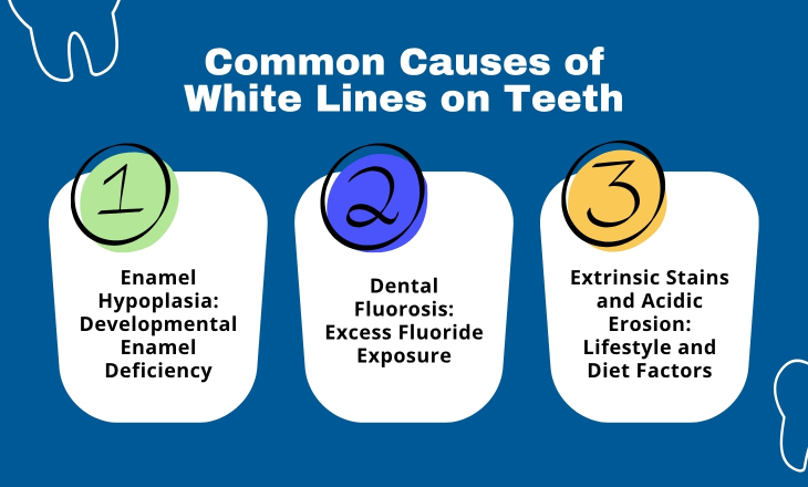 Common Causes of White Lines on Teeth Infographic