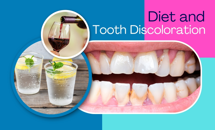 Image of Tooth Discoloration Beside Wine and Soda