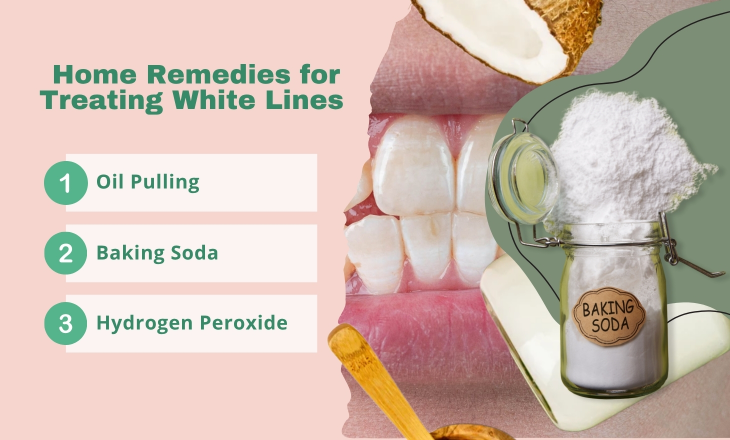 Home Remedies for Treating White Lines on Teeth