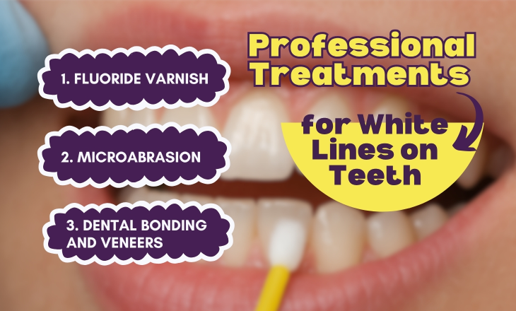 Fluoride Varnish Treatment Close up