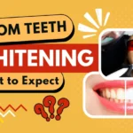 Zoom Teeth Whitening What to Expect