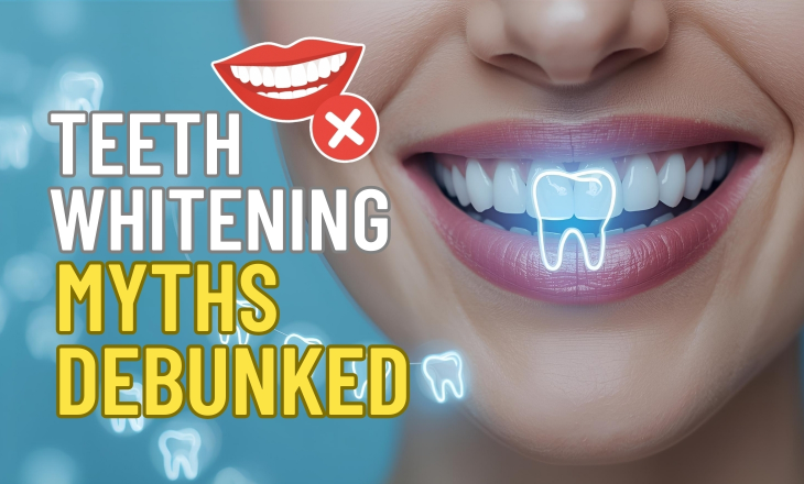 Teeth Whitening Myths Debunked
