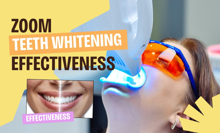 Zoom Teeth Whitening Effectiveness