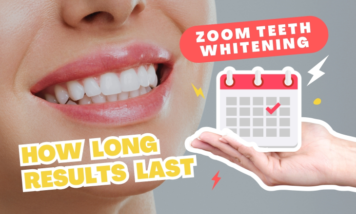 Zoom Teeth Whitening Longevity Hand is Holding a Calendar Next to Woman's Face