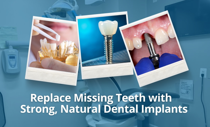 Missing Teeth Three Images of Dental Implant