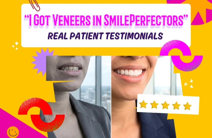 A split-face comparison featuring natural-looking porcelain veneers benfore and after.