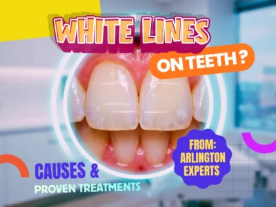 White Lines on Teeth? Arlington Experts Reveal Causes & Proven Treatments