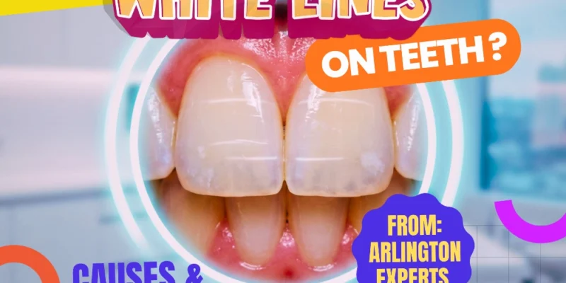 A hyper-realistic macro close-up of a human smile showcasing horizontal white lines