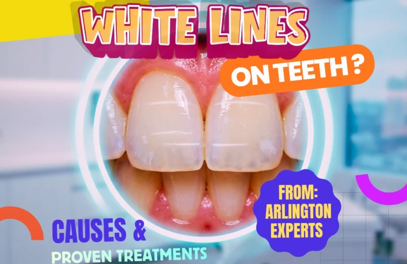 A hyper-realistic macro close-up of a human smile showcasing horizontal white lines